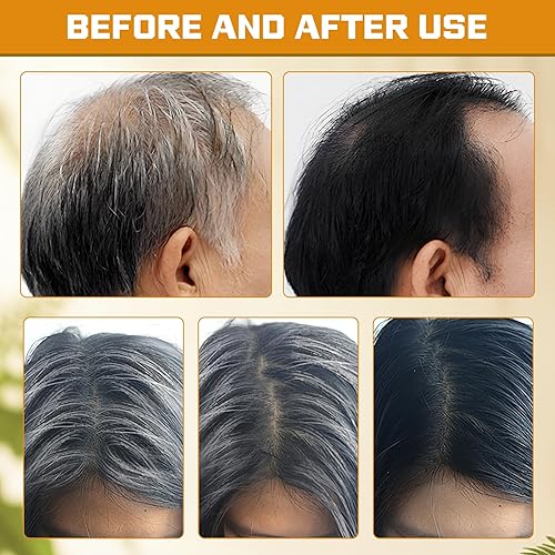 Miniatura 5 de Atsy Jabón en barra de cabello gris, jabón negro natural para cobertura de cabello gris, barra de champú oscurecimiento con ginseng y sésamo negro,