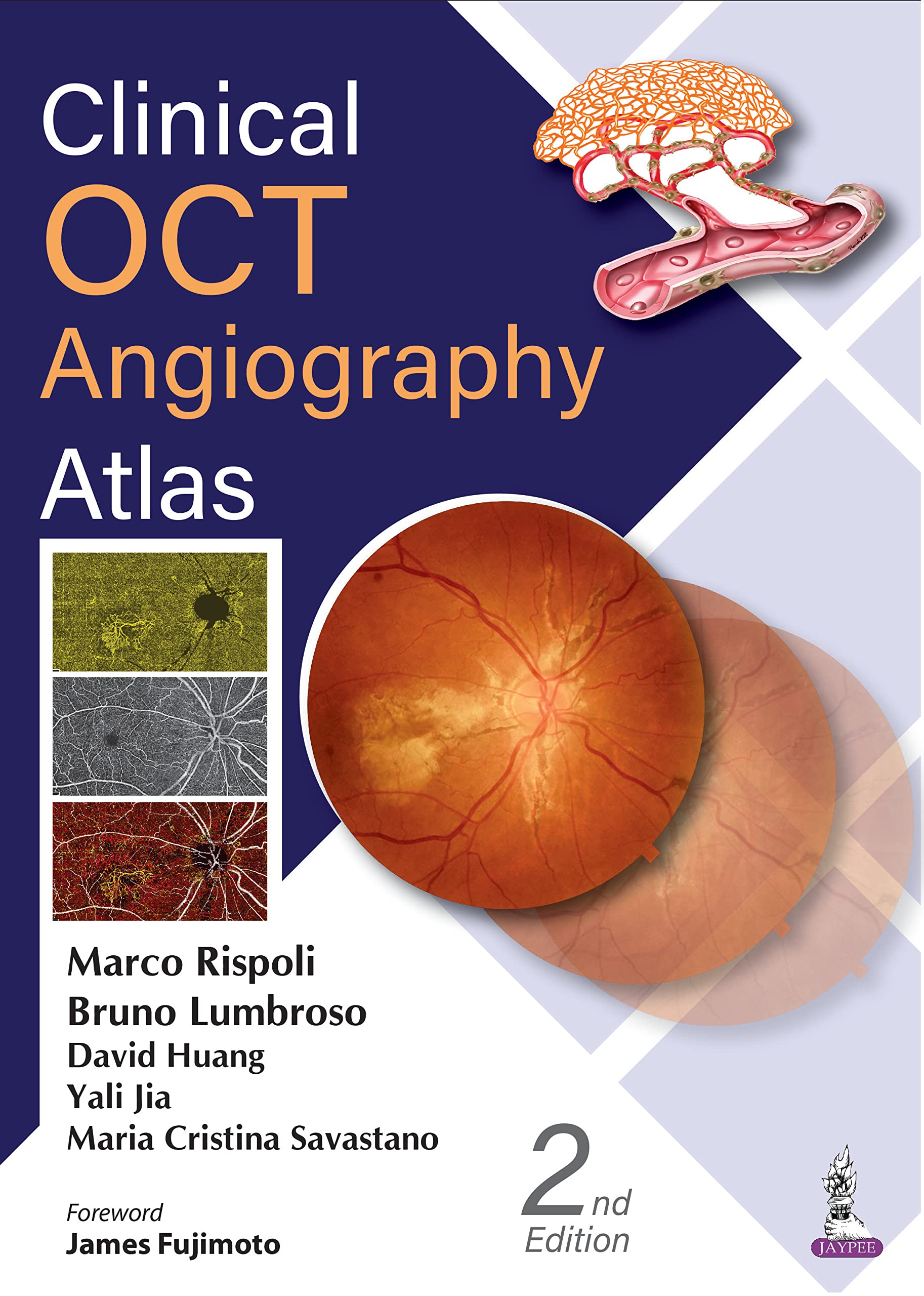 Clinical OCT Angiography Atlas (English Edition)