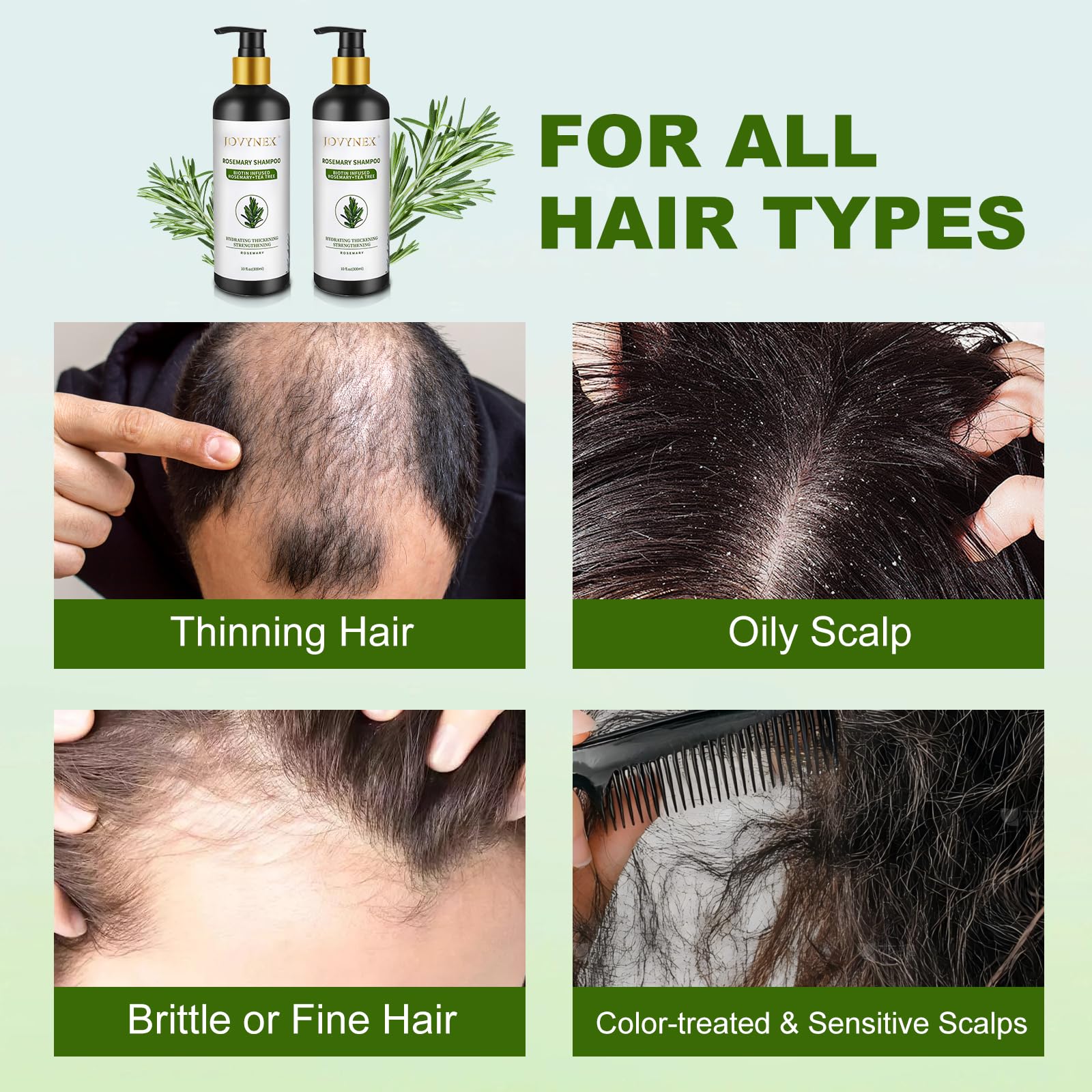 Champú para el crecimiento del cabello con romero, 10 onzas líquidas 4