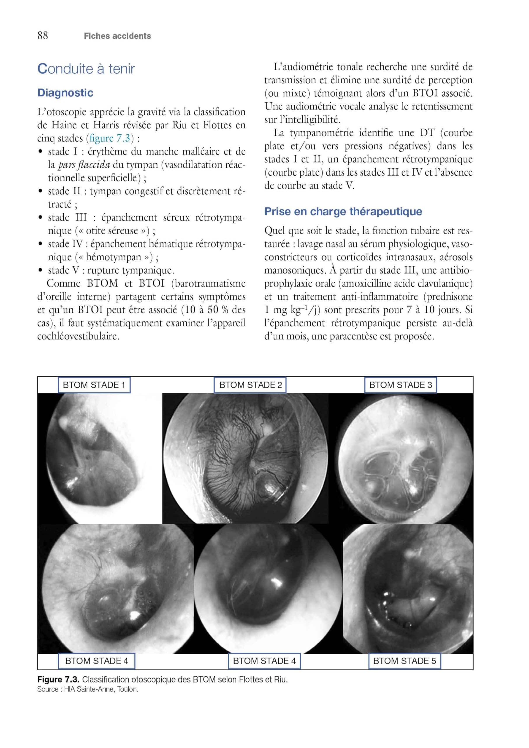 Médecine de la plongée: Physiopathologie, diagnostic, traitement et prévention des accidents de la plongée subaquatique et