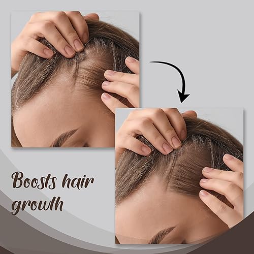 Miniatura 2 de HerStyler Suero capilar de aceite de ricino para el crecimiento del cabello, suero de brillo capilar con vitamina E, suero para el crecimiento del