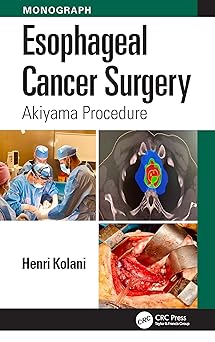 Esophageal Cancer Surgery: Akiyama Procedure-Wow! eBook