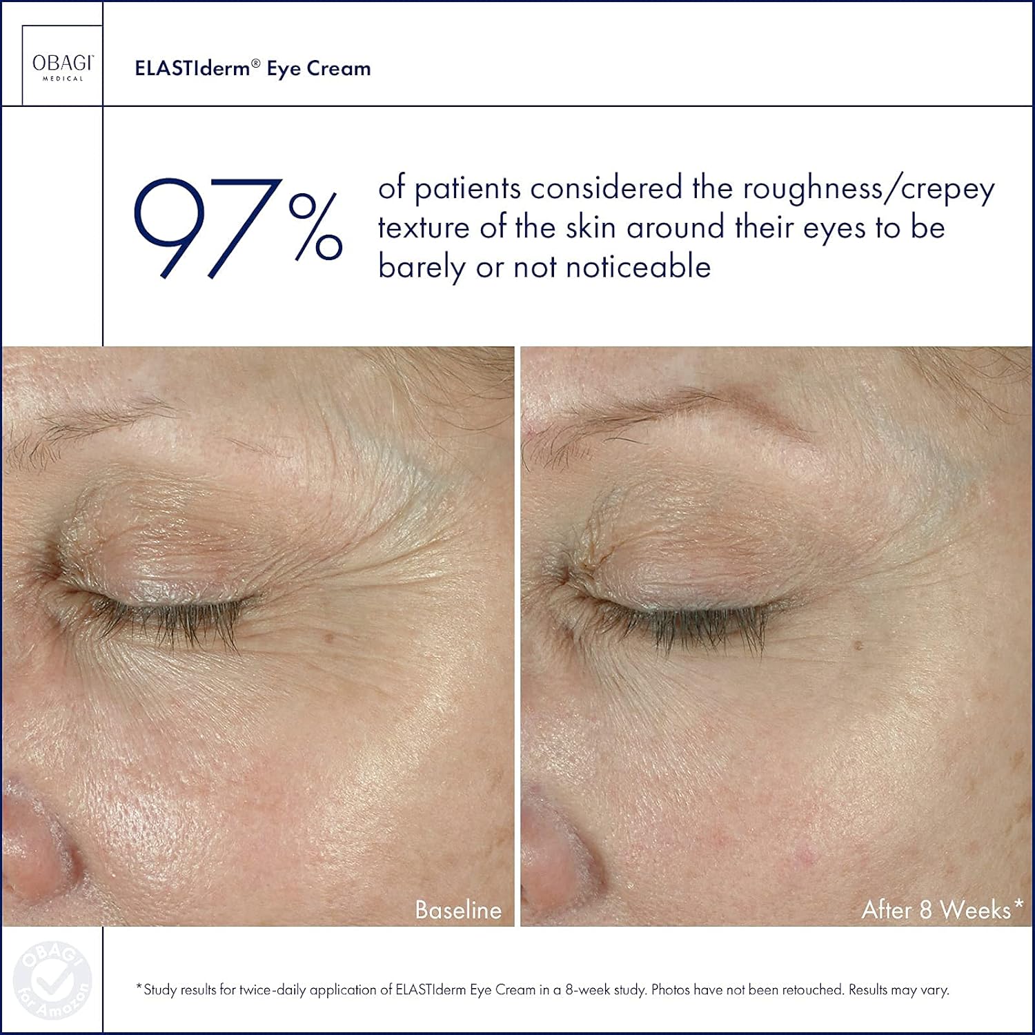 Obagi ELASTIderm Eye Cream, Firming Eye Cream for Fine Lines and Wrinkles, Ophthalmologist Tested, 0.5 oz : Beauty & Personal Care