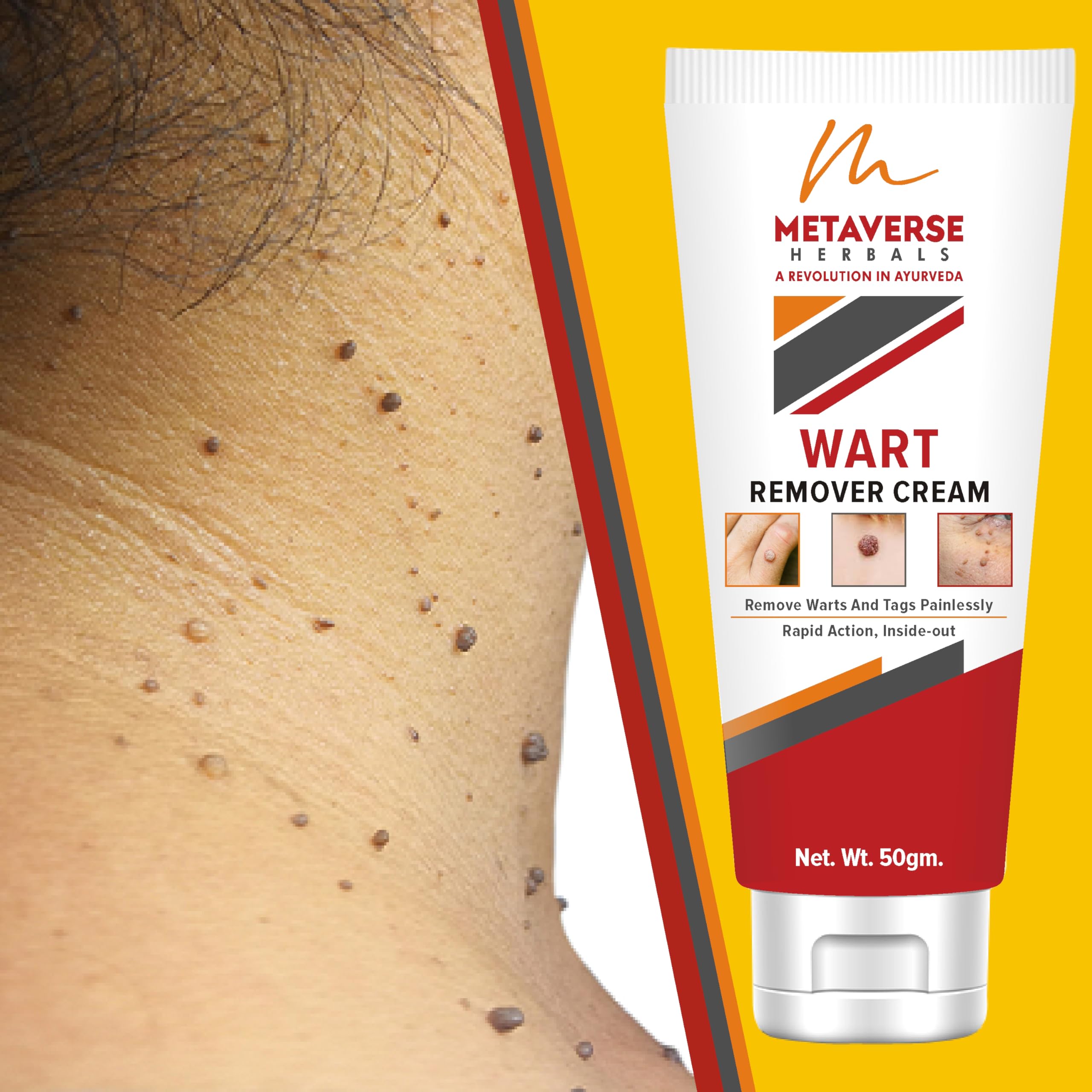 Metaverse Wart Remover Ointment For Men & Women Wart Removal Cream Skin Tags Remover Cream Skin Tags Remover Ointment For Face Skin Care (50 G) (B0CZHHB7C3) Amazon Price History, Amazon Price Tracker