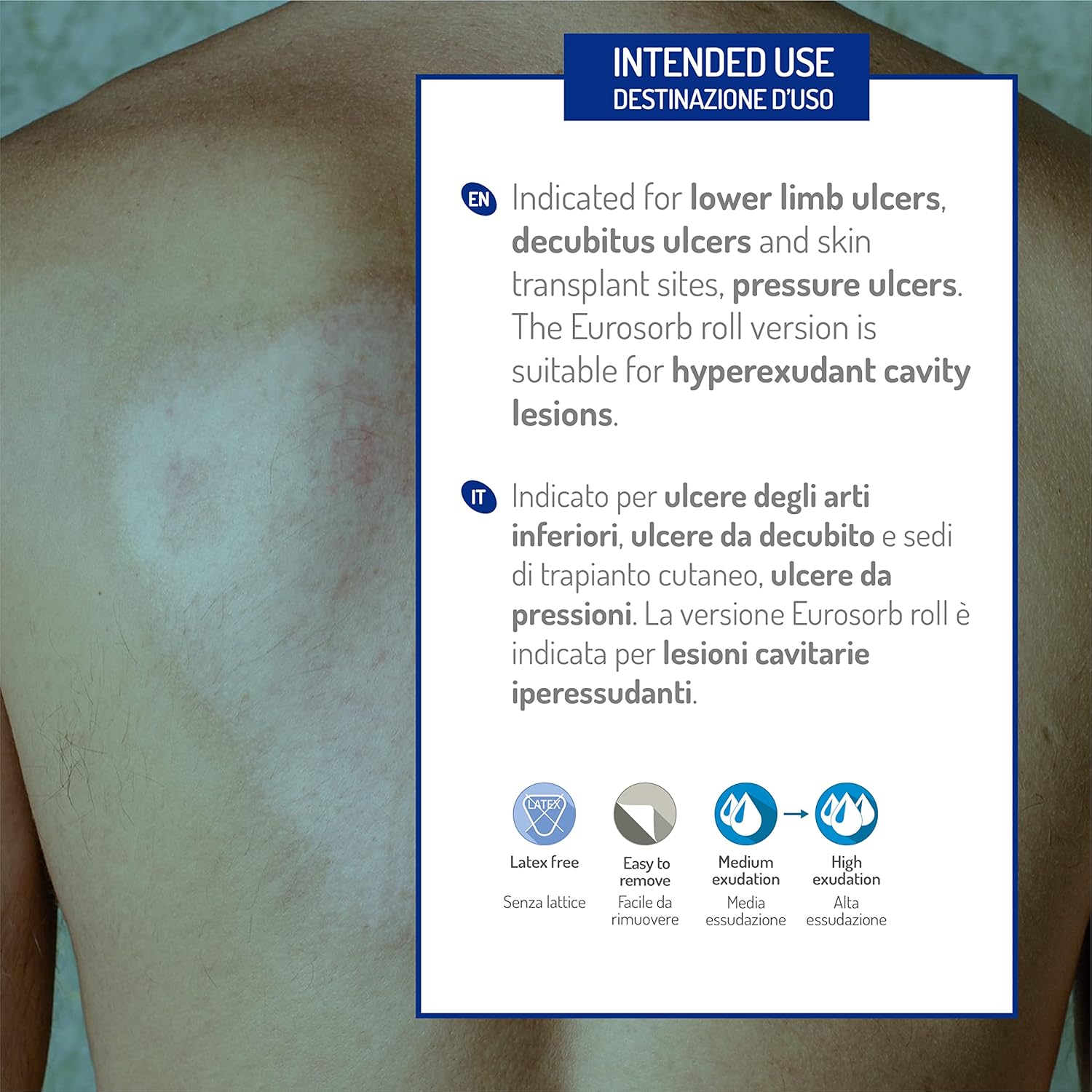 Eurosorb 4 x 4 Inches Ulcer Wound Dressing – High Integrity Calcium Alginate Fibers, Sterile Soft and Highly Absorbent Dressing – 10 Pieces : Health & Household