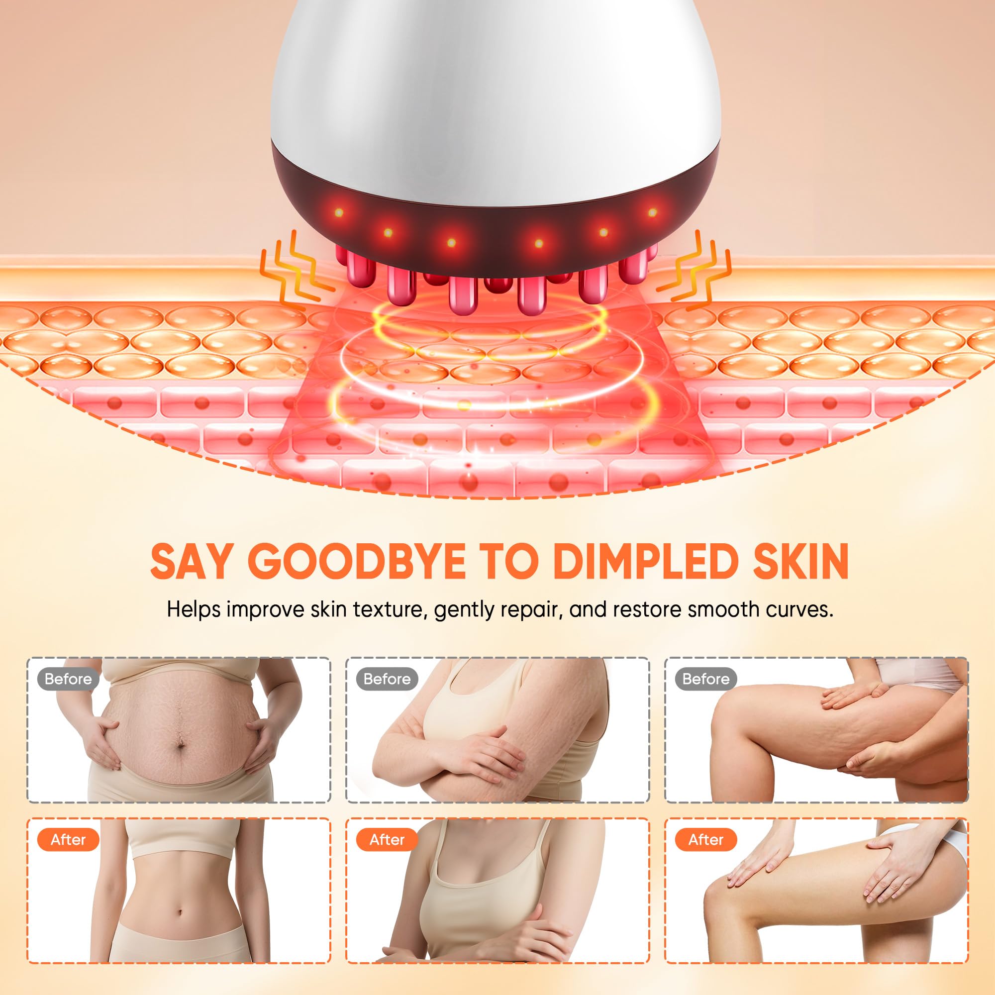 Massaggiatore per drenaggio linfatico e strumento per massaggio anticellulite, blaster per fascia per cellulite, aiuta a ridurre le smagliature per gambe, braccia e pancia, macchina per scolpire il