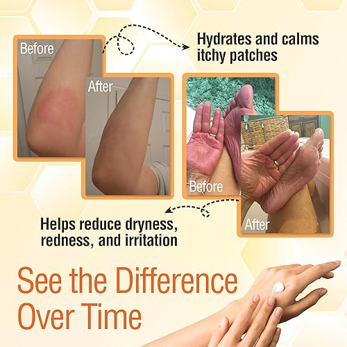 Miniatura 3 de Crema de miel de manuka para curación e hidratación de Wild Naturals 4 onza