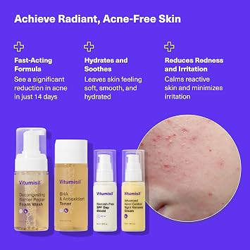 Dermz Vitumisil Acne Treatment Set of 4 - Cream, SPF, Wash & Toner