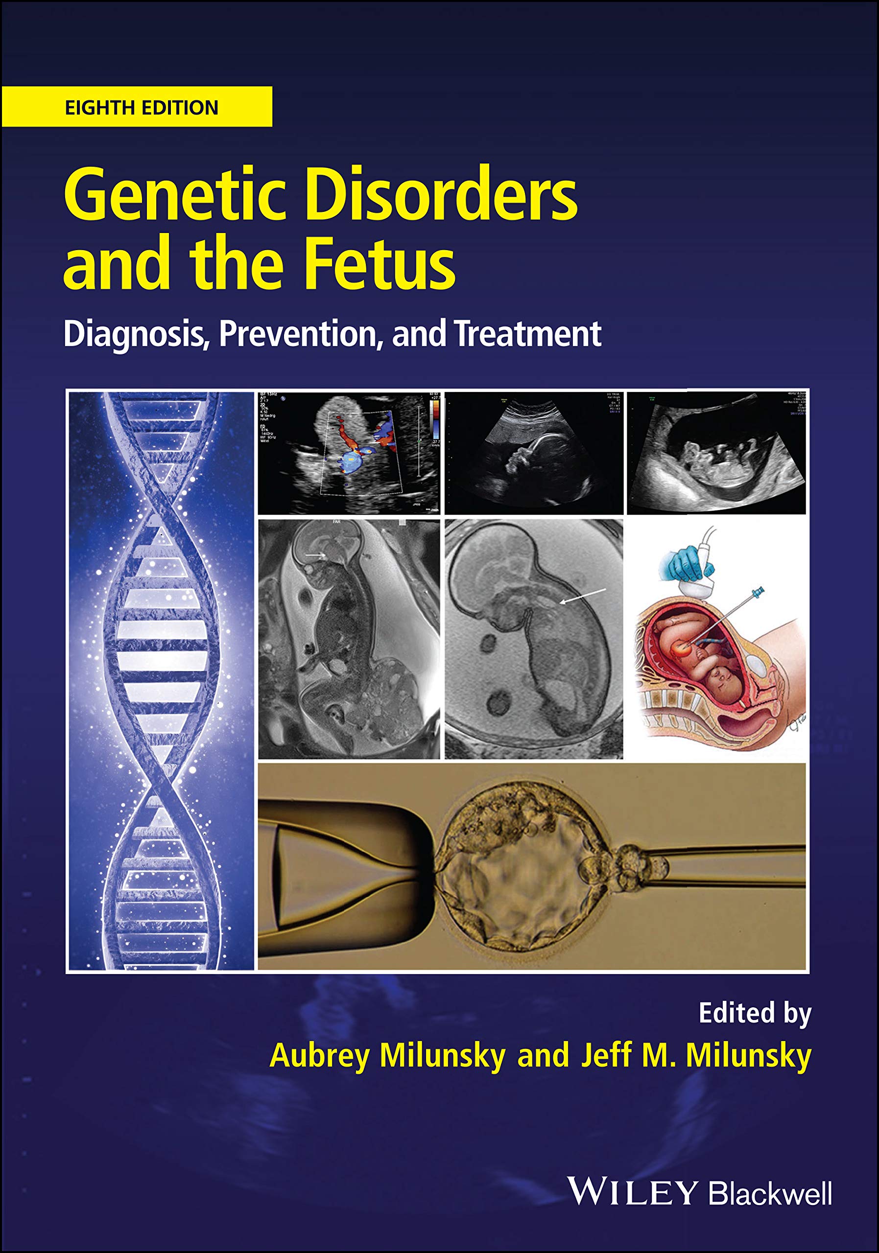Buy Genetic Disorders and the Fetus: Diagnosis, Prevention and