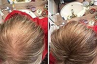 Vista 3 de caboki Pérdida de cabello Concealer de 30g (90días de suministro), Marrón claro