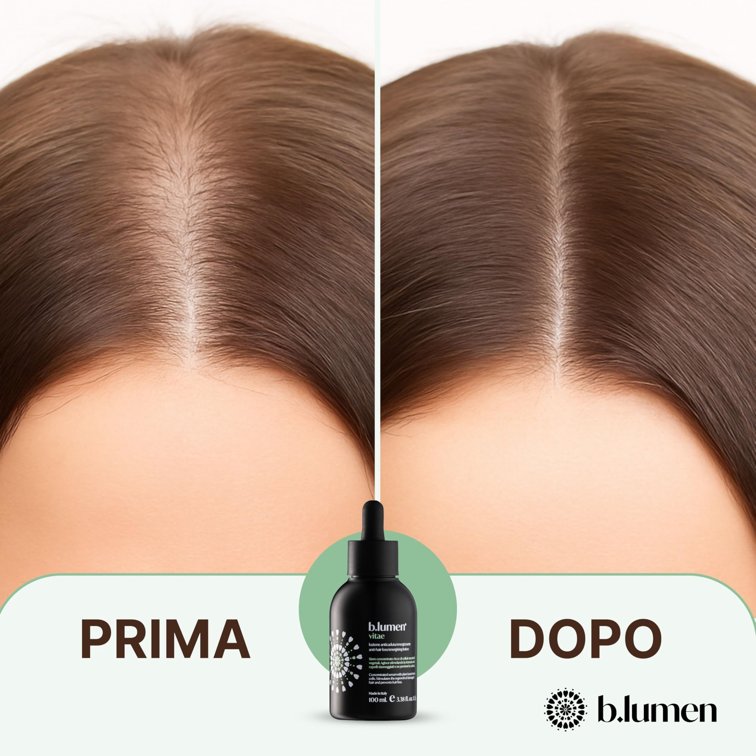 B.lumen Vitae Lozione Anticaduta Capelli Uomo Donna – Trattamento Rinforzante e Energizzante – Stimola la Ricrescita dei Capelli – Made in Italy, 100 ml