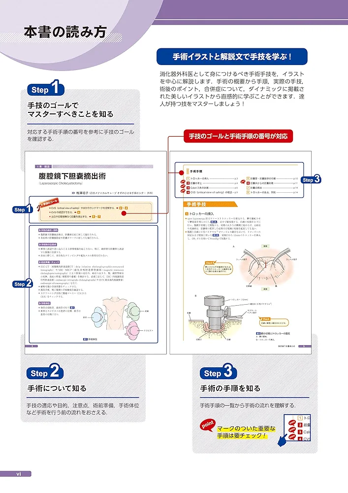 消化器外科手術 胆道・膵臓 標準手技のポイントをイラストと動画で学ぶ Amazon.co.jp: 消化器外科手術 胆道・膵臓 ~標準手技のポイント