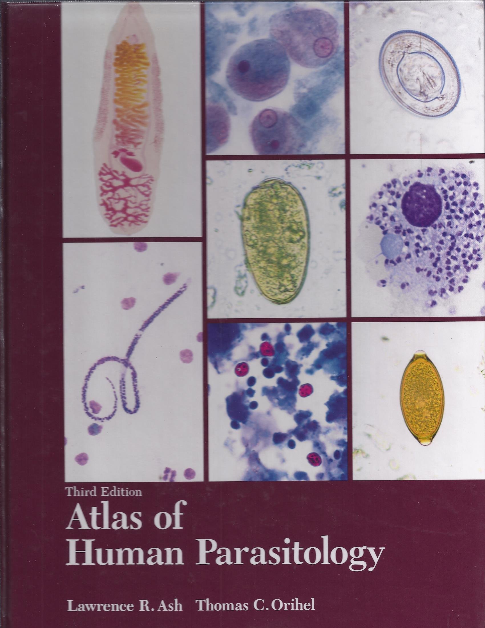 Atlas of Human Parasitology