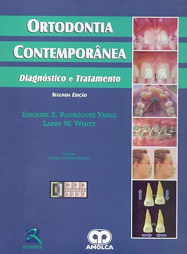 Ortodontia Contemporânea: Diagnóstico e Tratamento