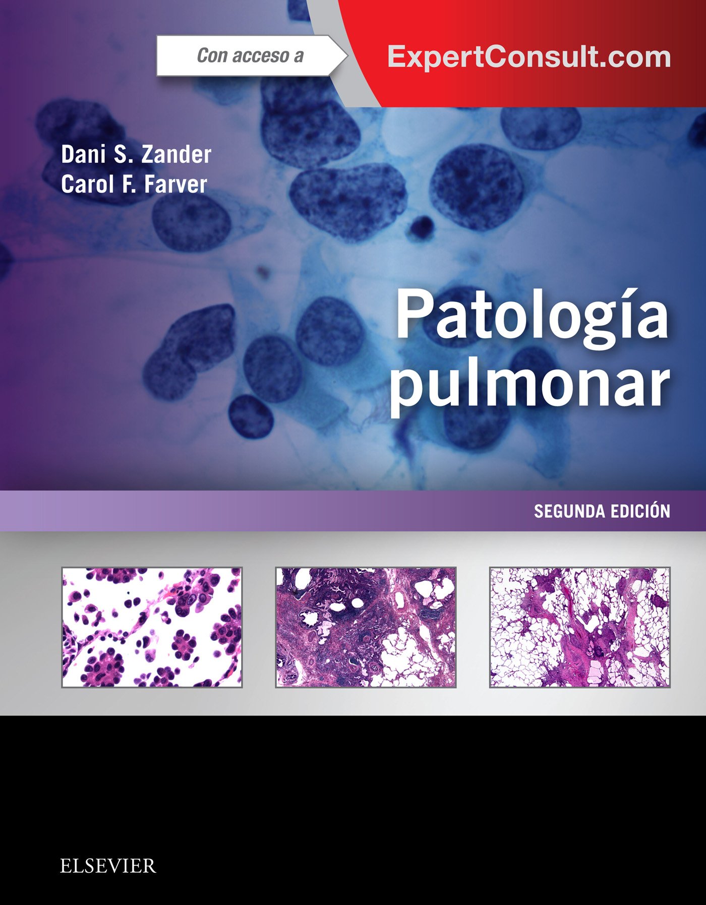 Patología pulmonar