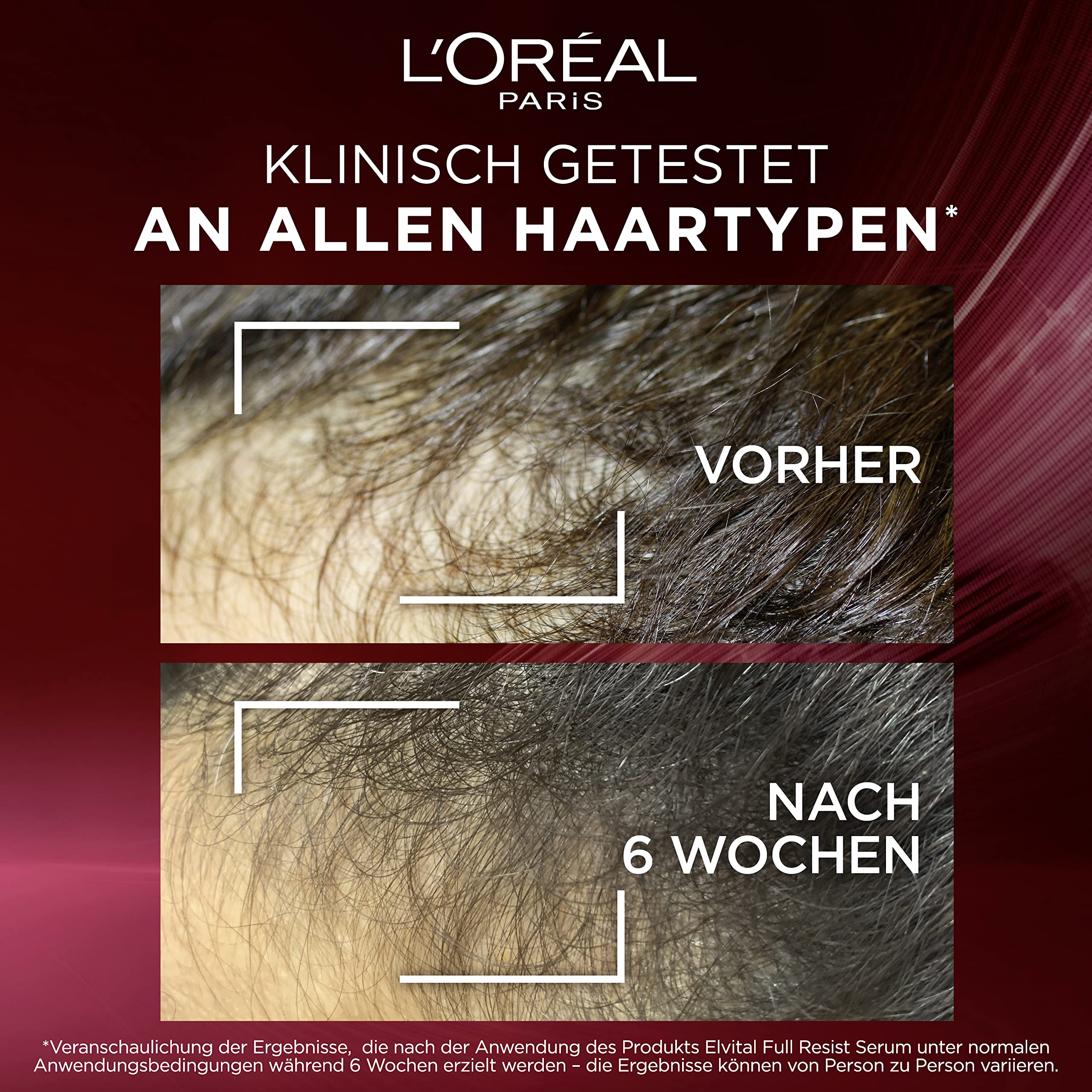 L'Oréal Paris Elvital serum przeciw wypadaniu włosów na skutek łamania włosów, do bezsilnych, łamliwych włosów, zawiera 1,5% amineksylu, kofeinę i argininę, całkowicie odporne na wypadanie włosów, 1 x
