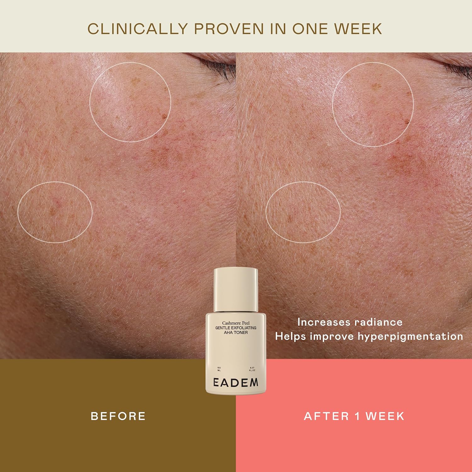 EADEM Gentle Exfoliating AHA & PHA Toner, Milky Rice Toner Exfoliant with Lactic, Azelaic, & Tranexamic Acid, Rice Water AHA Exfoliator & Pore Minimizer for Face and Body, 5.0 oz, Cashmere Peel - Image 4