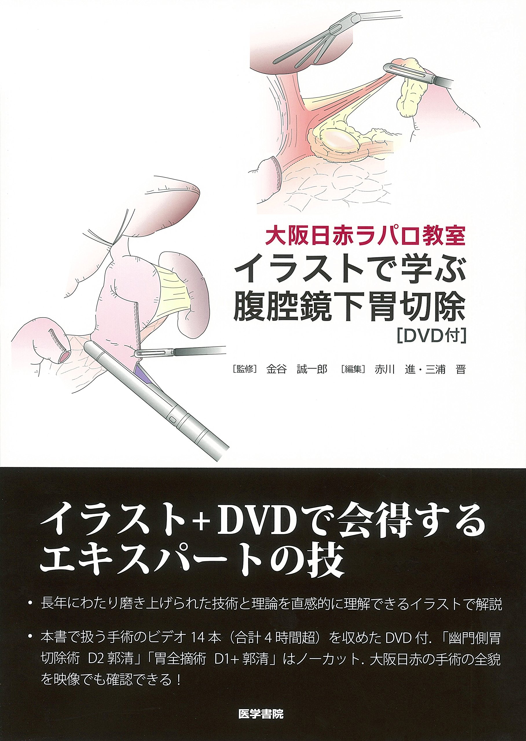 大阪日赤ラパロ教室 イラストで学ぶ腹腔鏡下胃切除 Dvd付 金谷 誠一郎 赤川 進 三浦 晋 配送料無料