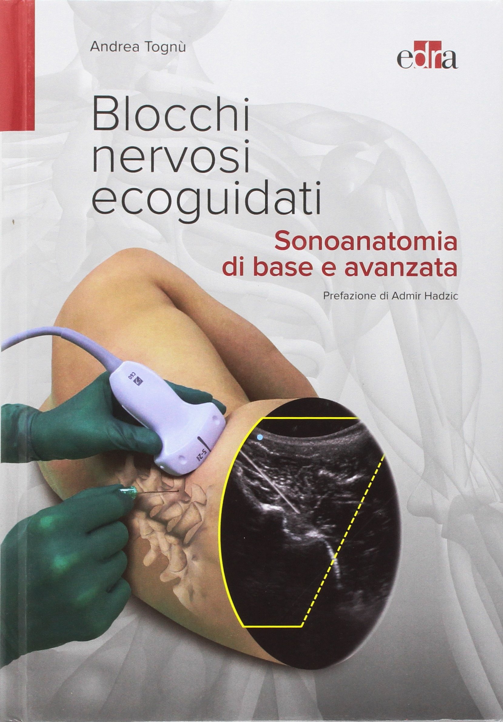 Blocchi nervosi ecoguidati. Sonoanatomia di base avanzata