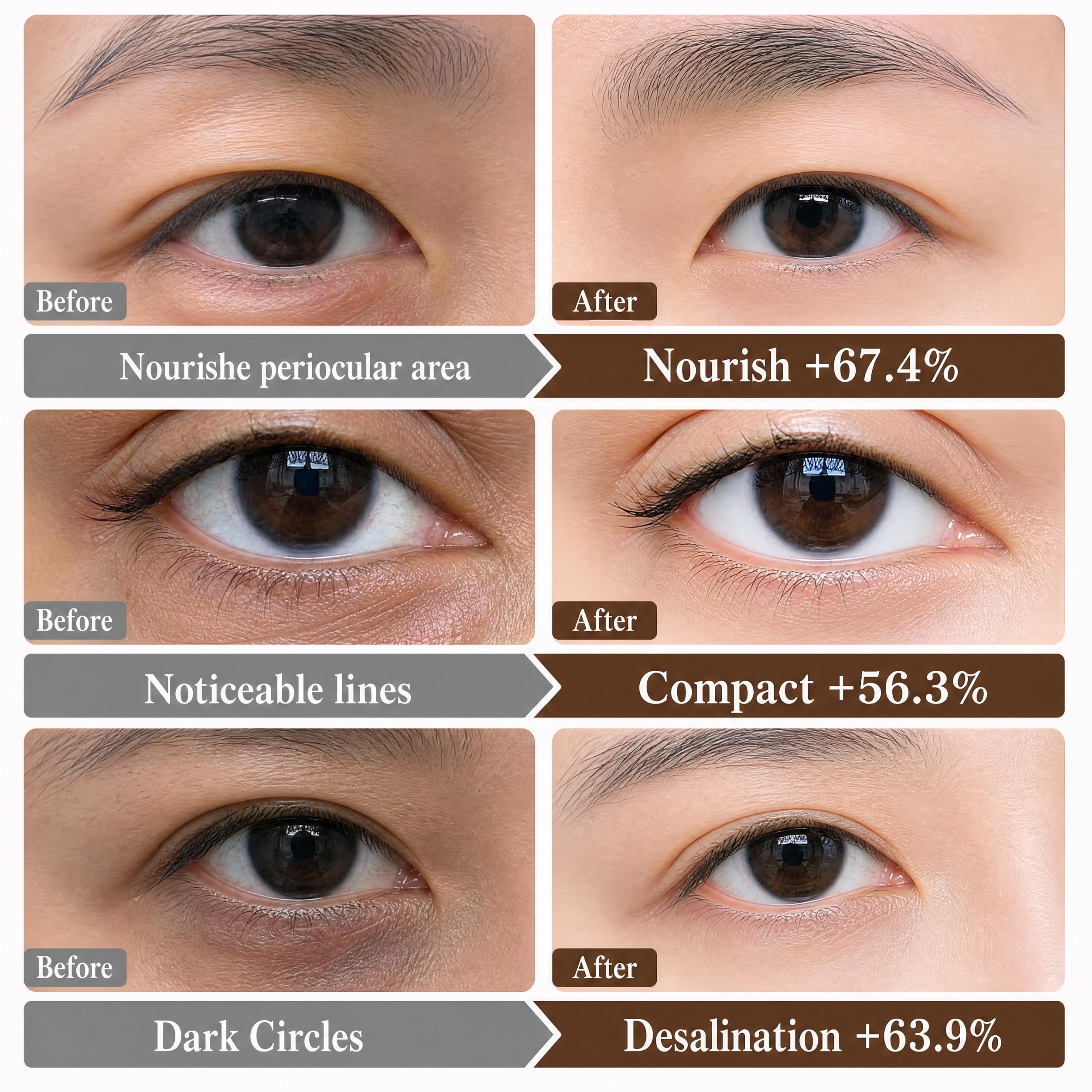 Novoy Bio-Collagen Real Deep, Nachtpflaster mit Retinol, 6-in-1 für Augenringe, Taschen und Falten, 2 % Koffein + Hyaluronsäure + Niacinamid, koreanische Maske P