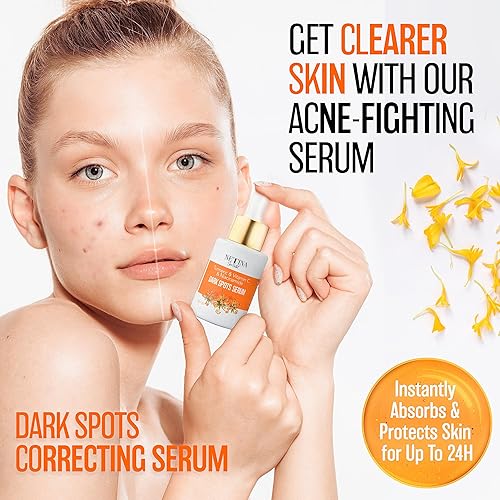 Miniatura 2 de NETINA SKIN RESTART Suero de vitamina C – Corrector de manchas oscuras iluminador con niacinamida y cúrcuma – Suero facial antienvejecimiento e