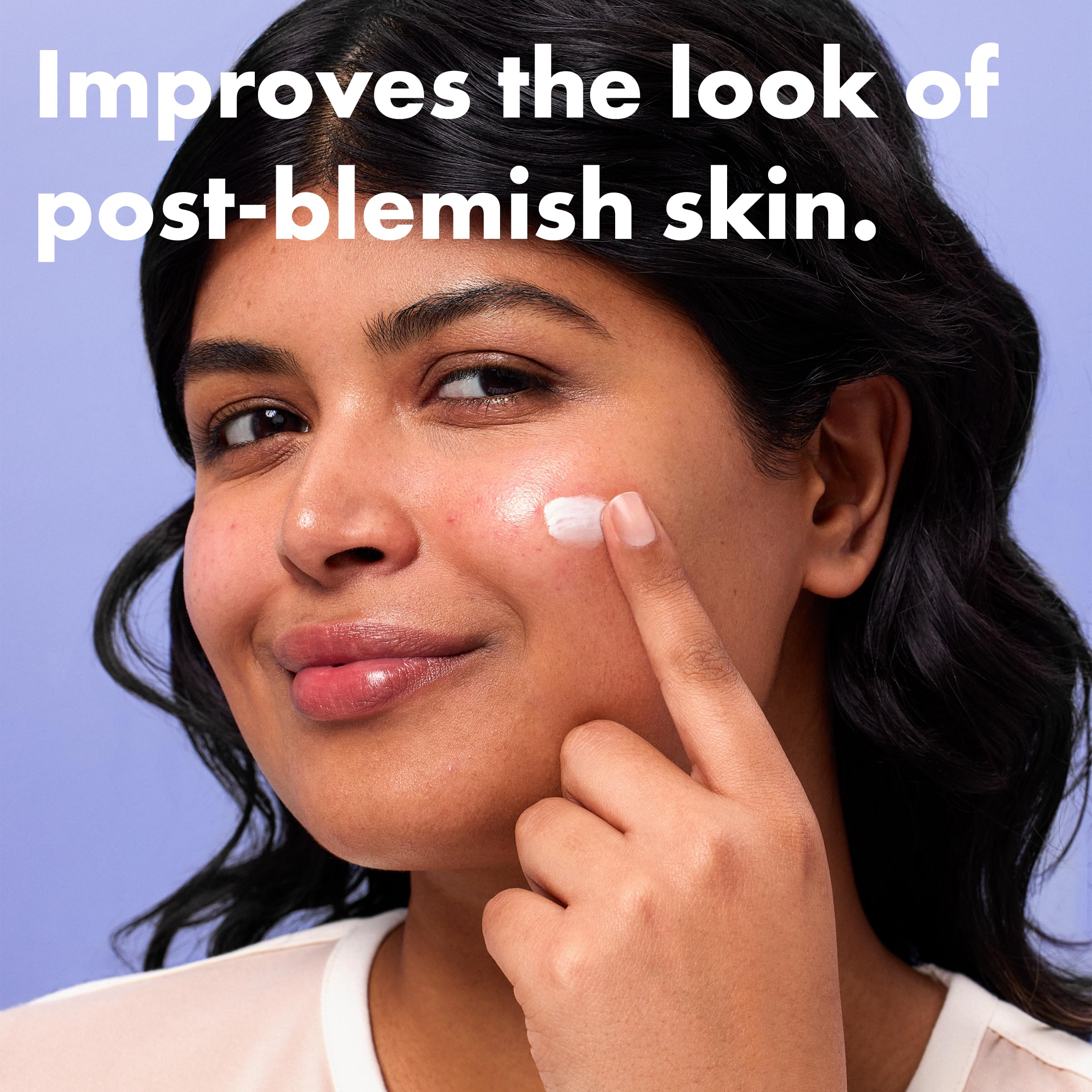 Hero Cosmetics Rescue Balm Post-Blemish Recovery Cream - Image 2