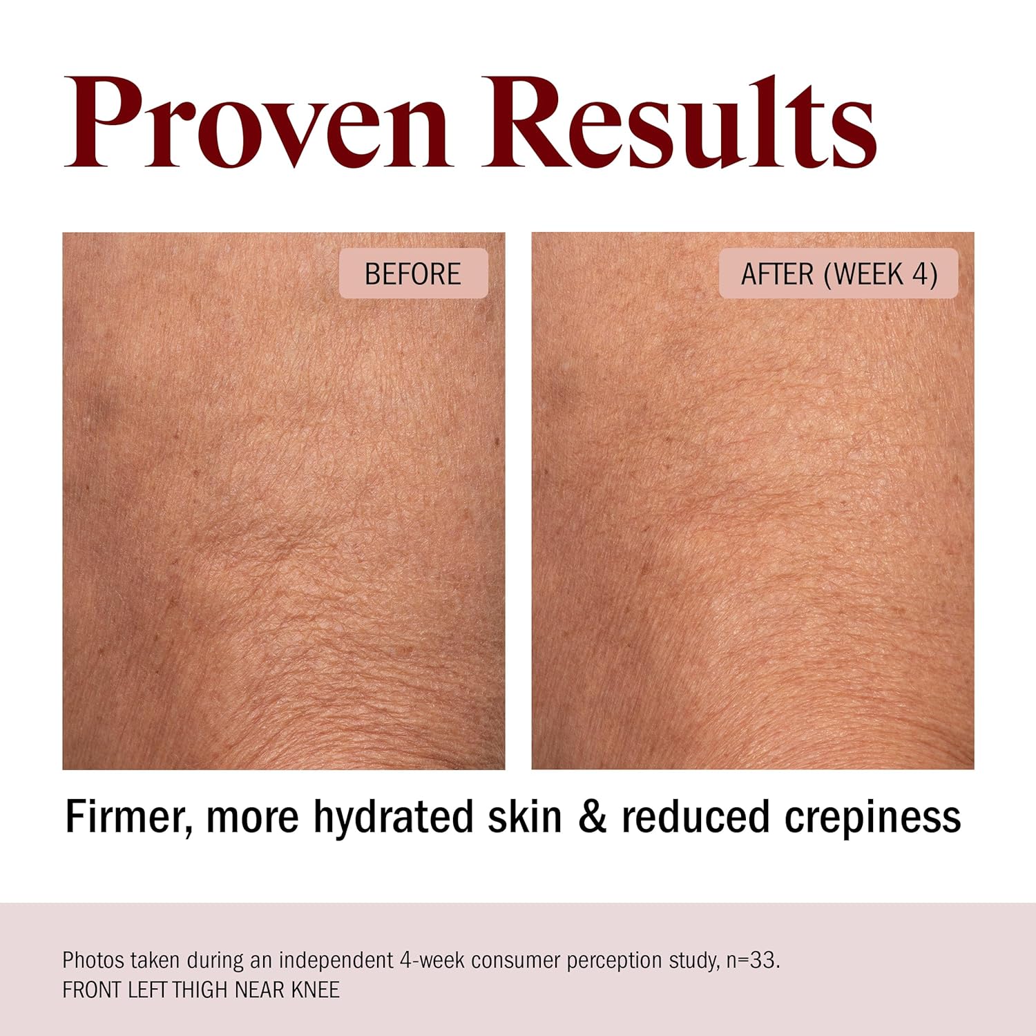 STRIPES Beauty (by Naomi Watts) - Rich & Tight Ultra Hydrating & Firming Peptide Body Butter with Ectoine and Squalane, Improves Skin Firmness, Texture and Tone, 16.48 oz - Image 4