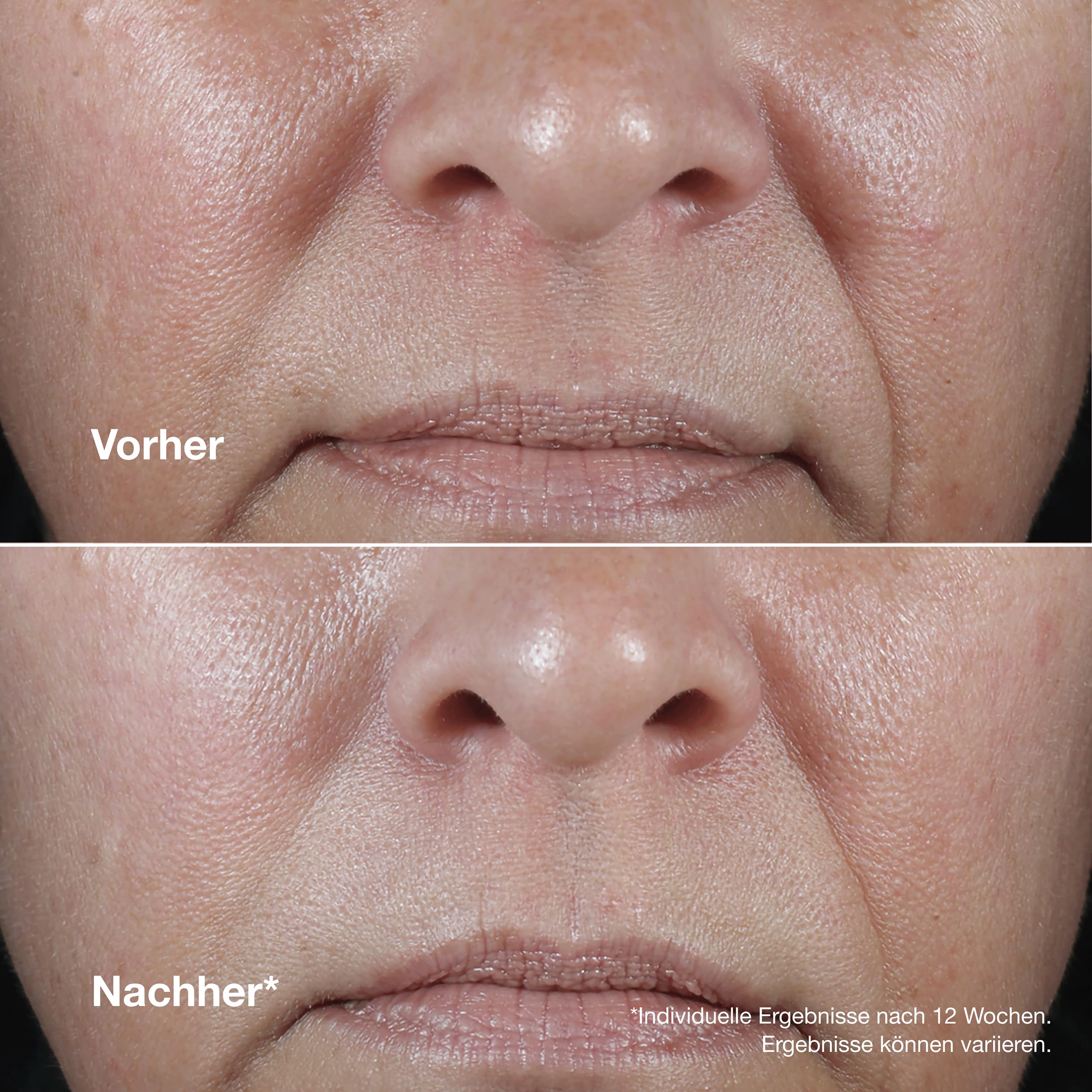 Clinique Smart Clinical Repair™ Wrinkle Correcting Rich Cream | Mit Peptiden + Hyaluronsäure | Anti-Aging und feuchtigkeitsspendend, 50 ml