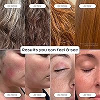 Vista 7 de Canopy Handheld Filtered Shower Head & Scalp Massager - High Pressure Shower Head Filter for Hard Water - Shower Filter To Reduce Impurities for