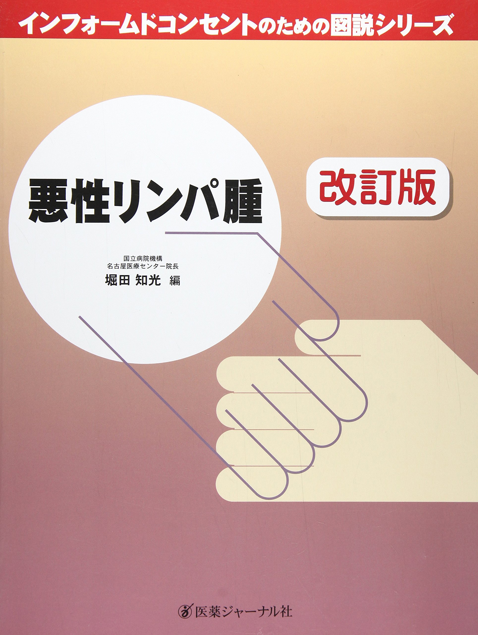 悪性リンパ腫 改訂版 (インフォームドコンセントのための図説シリーズ