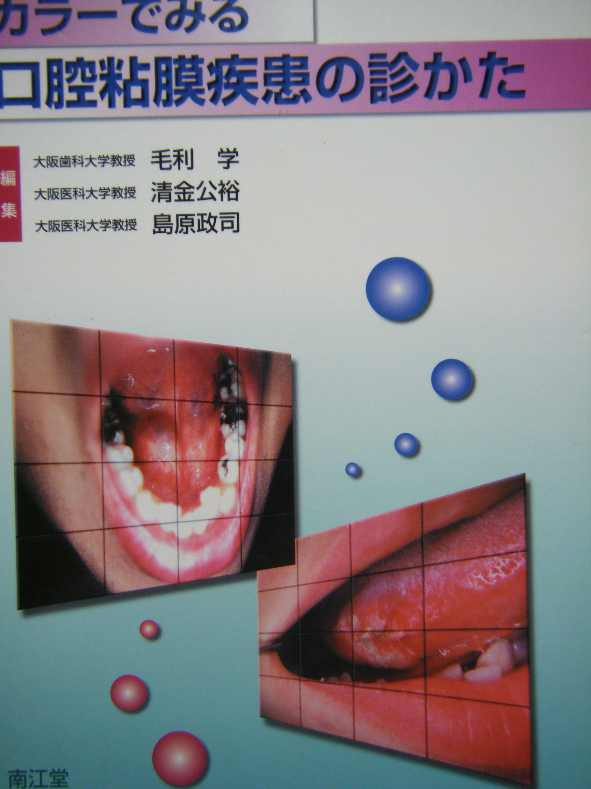 カラ-でみる口腔粘膜疾患の診かた | 毛利学, 清金公裕, 島原政司 |本