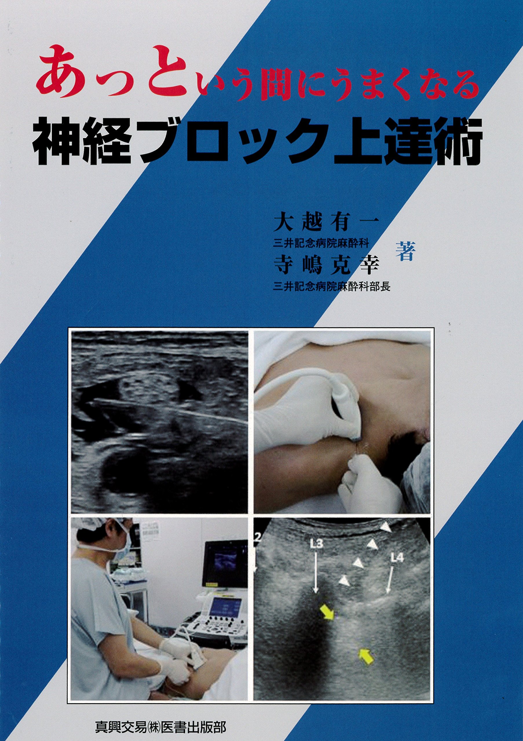 Amazon.co.jp: あっという間にうまくなる神経ブロック上達術 : 大越