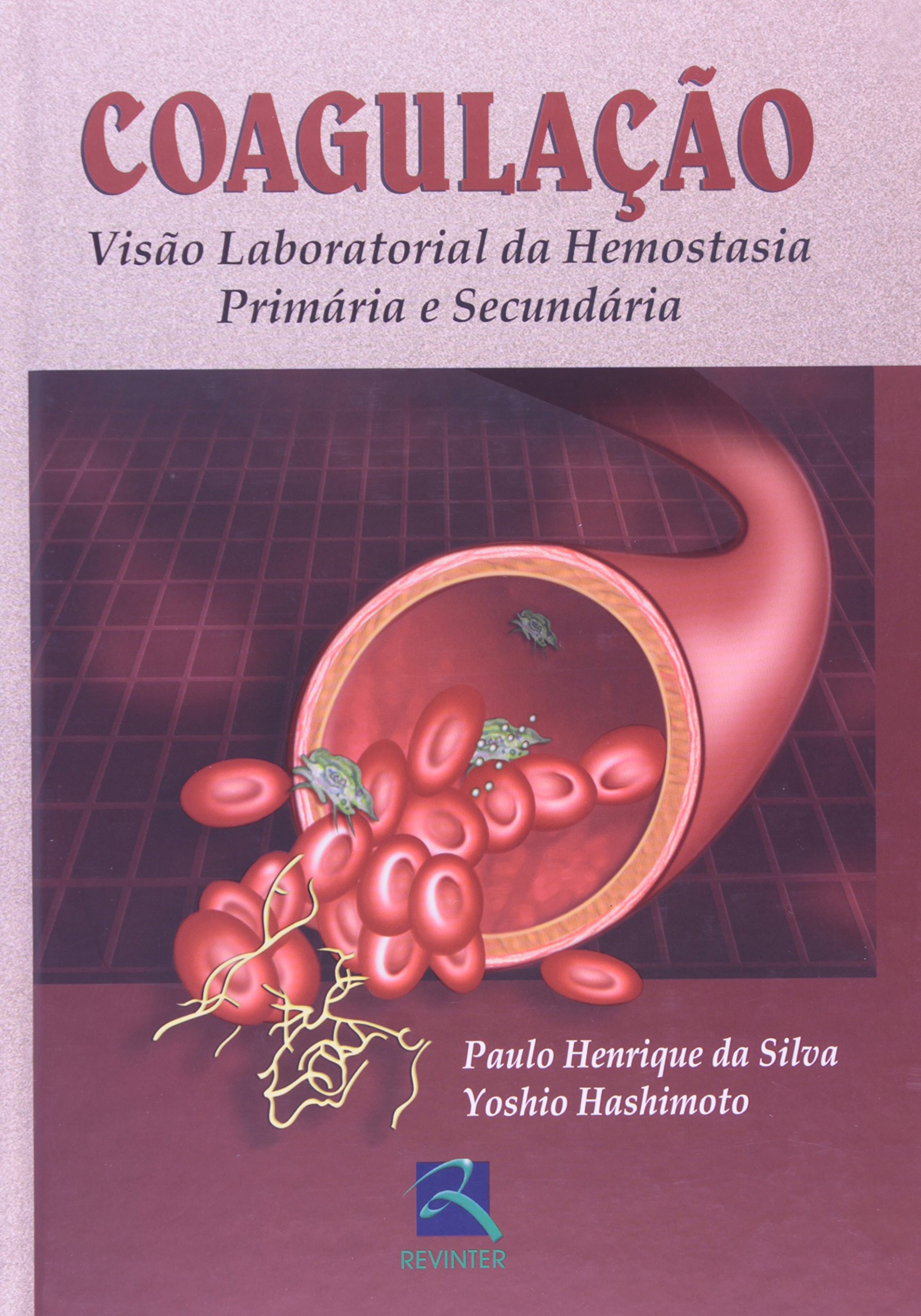 Coagulação: visão laboratorial da hemostasia primária e secundária