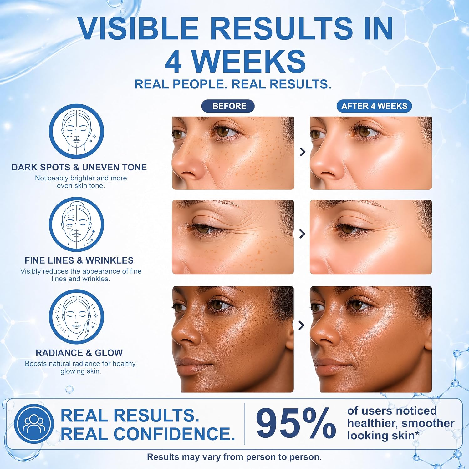 Anti-Aging Face Serum - Brightening Vitamin C Face Serum, Illuminating Formula for Improving Appearance of Dark Spots, Fine Lines & Wrinkles - Niacinamide Serum, Skin Care, All Skin Types 30 ml