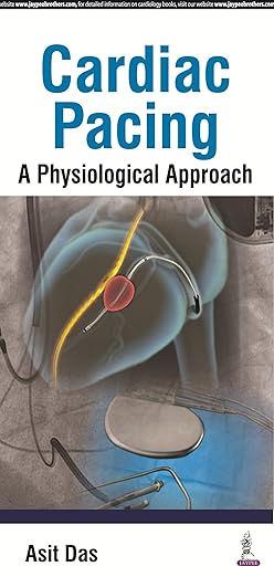 CARDIAC PACING A PHYSIOLOGICAL APPROACH
