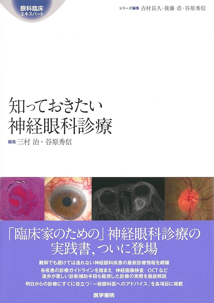 (裁断済み)知っておきたい神経眼科診療 Amazon.co.jp: 知っておきたい神経眼科診療 (眼科臨床