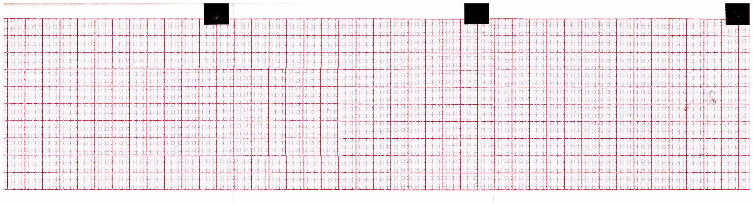 ECG Paper ZFOLD 60MM X 75MM X 250SHEETS (Works for 66010040, CARDIETTE
