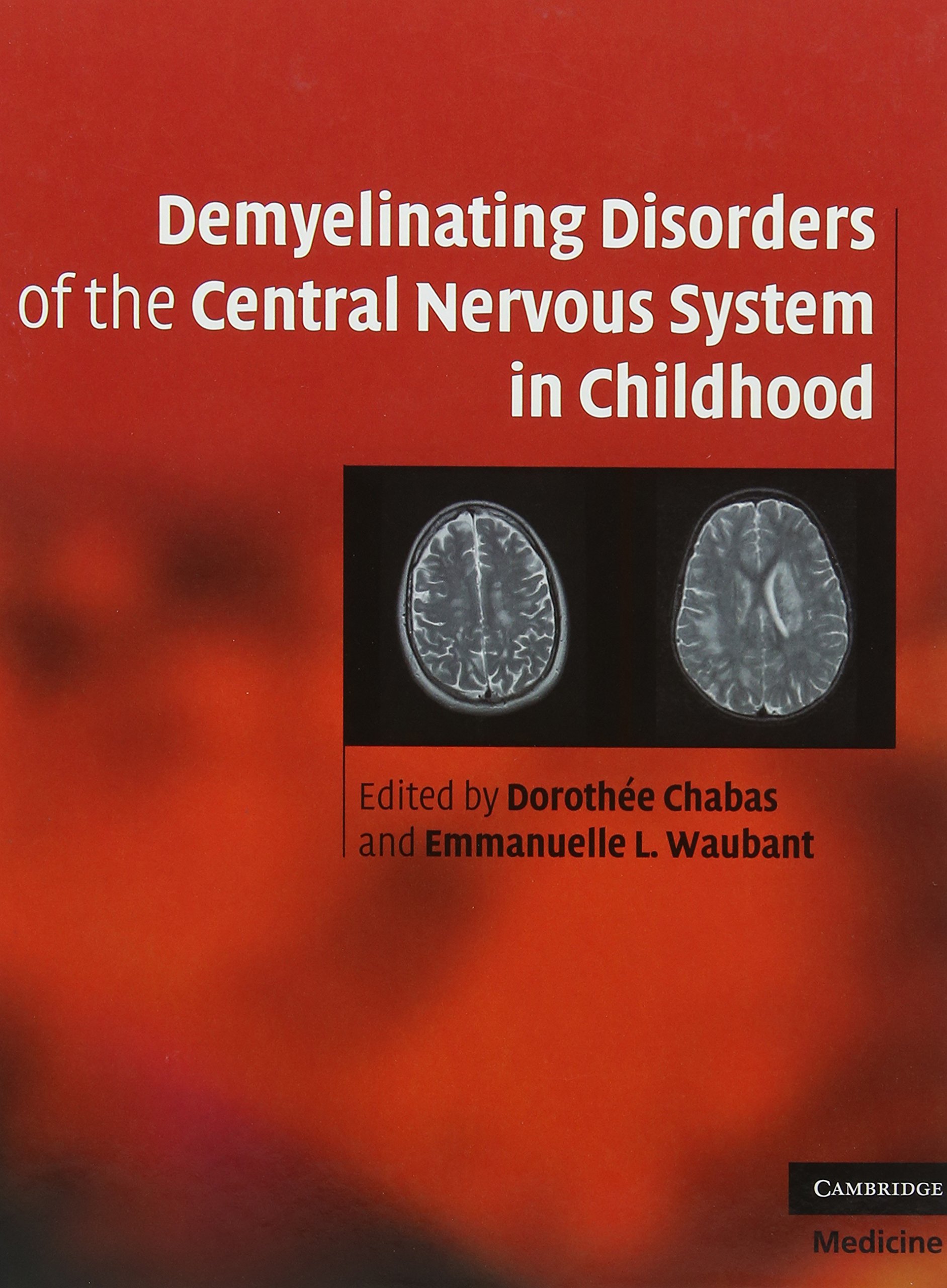 Demyelinating Disorders of the Central Nervous System in Chil... - 9780521763493