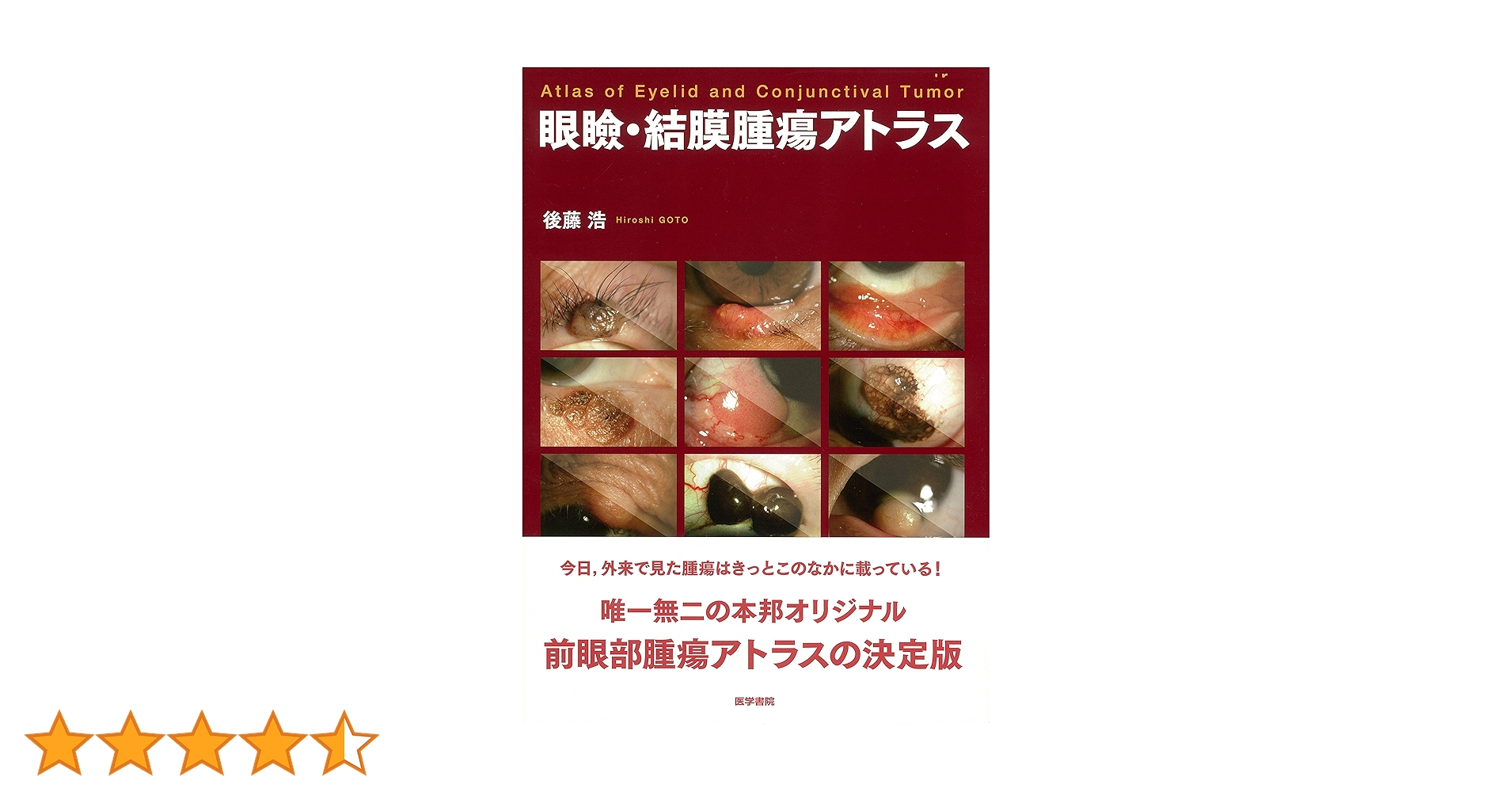 眼病理アトラス 眼疾患アトラスシリーズ 第4巻 眼病理アトラス｜株式会社総合医学社