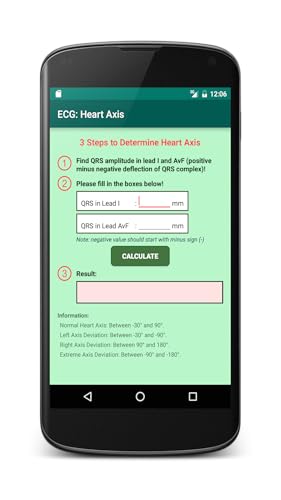 ECG: Heart Axis