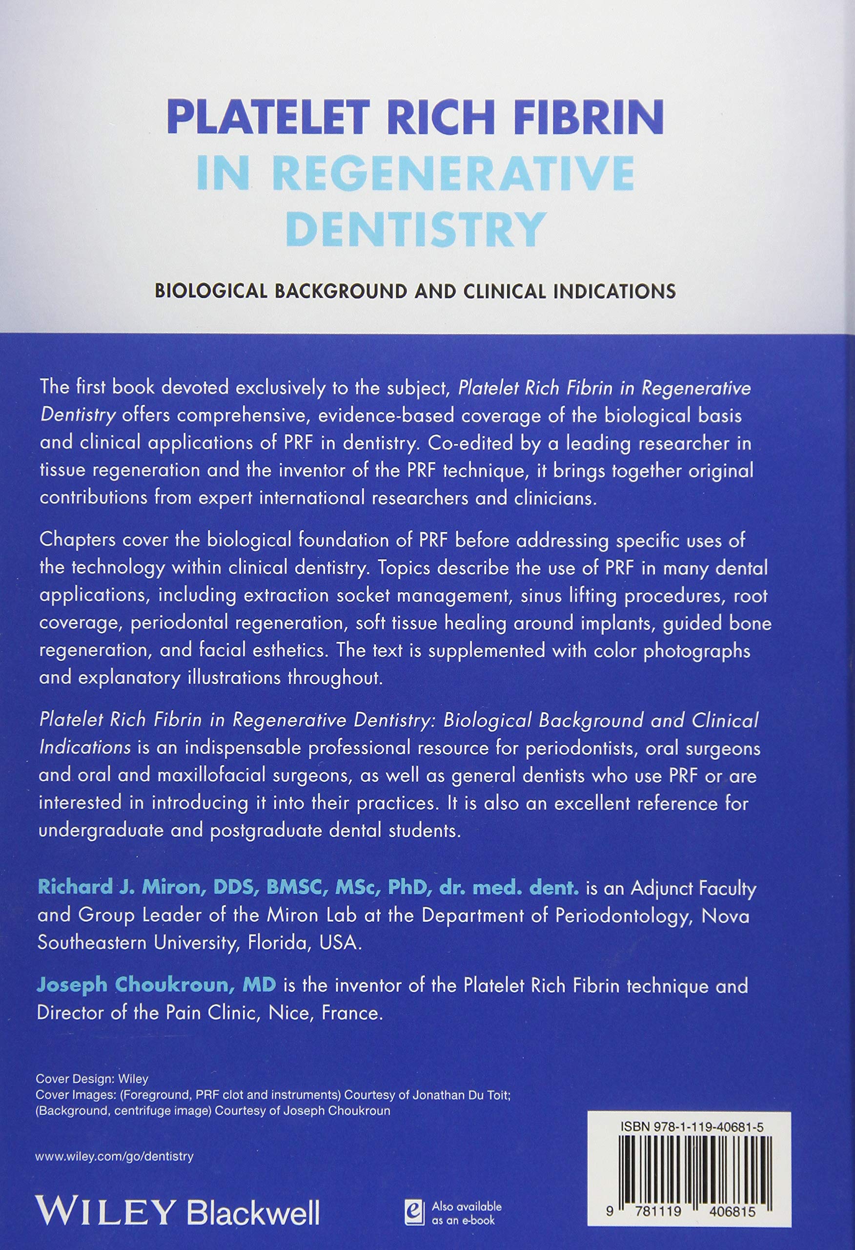 Platelet Rich Fibrin in Regenerative Dentistry: Biological Background and Clinical Indications
