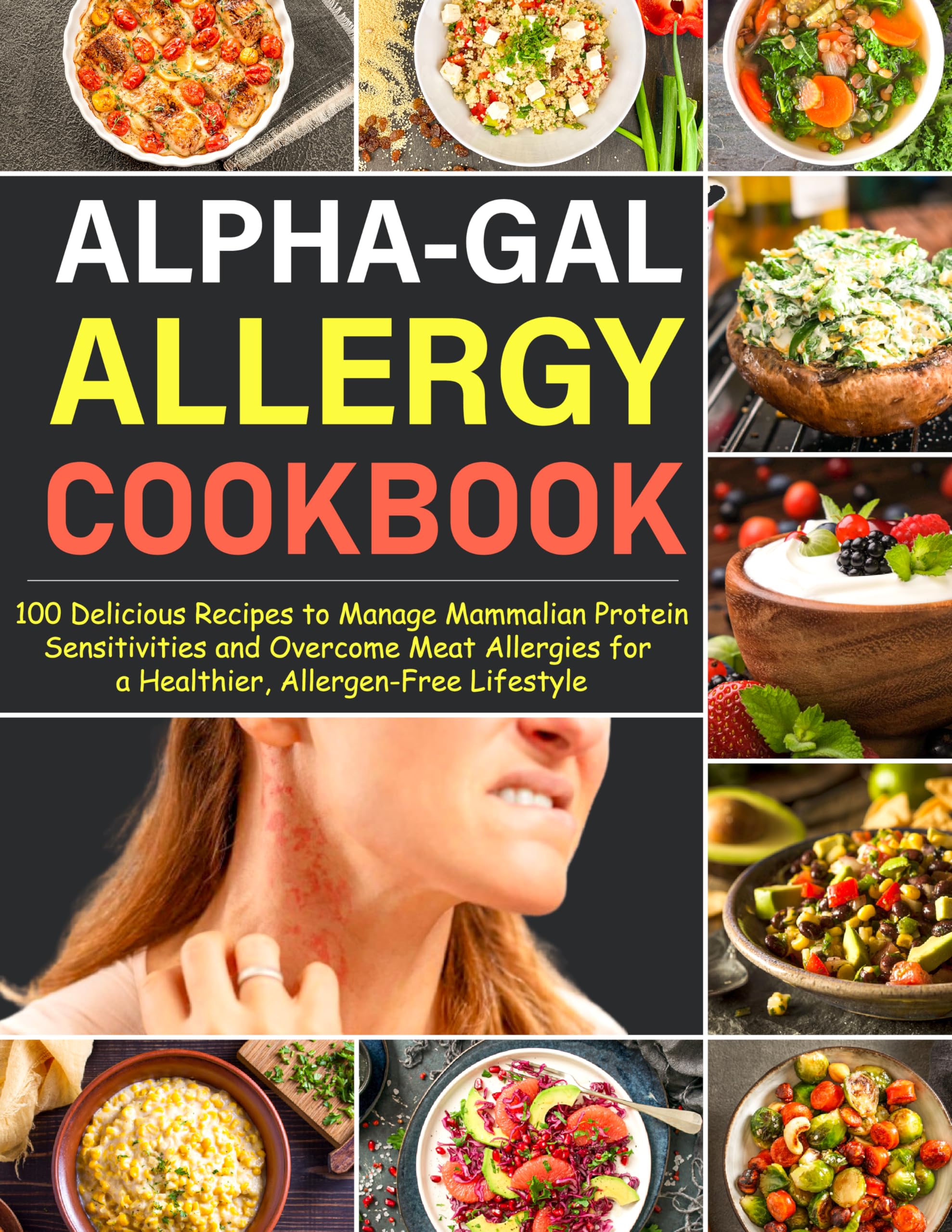 Alpha-Gal Allergy Cookbook: 100 Delicious Recipes to Manage Mammalian Protein Sensitivities and Overcome Meat Allergies for a Healthier, Allergen-Free Lifestyle