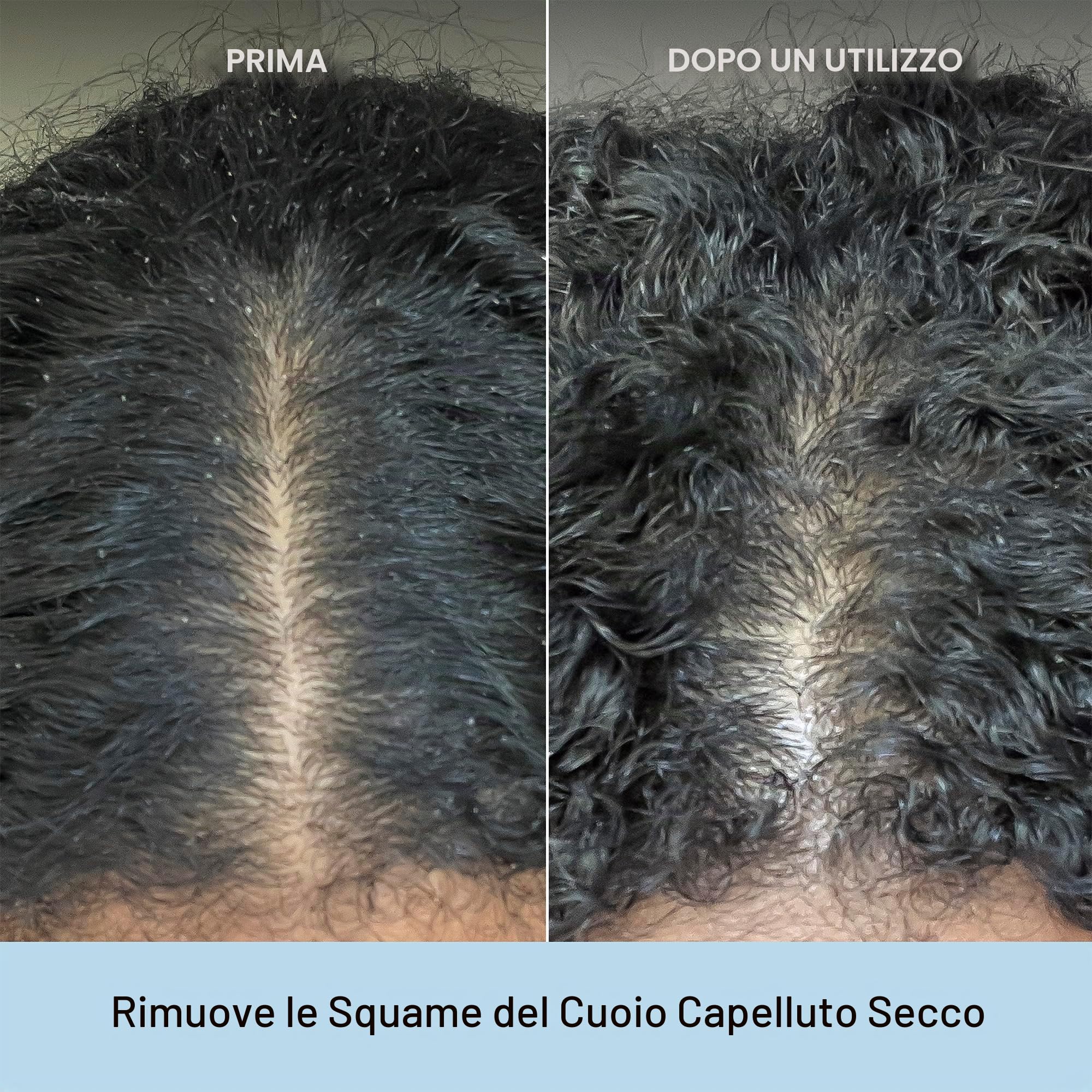 Scalp Revival Charcoal + Coconut Oil Micro-Exfoliating Shampoo 236ml