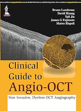 CLINICAL GUIDE TO ANGIO-OCT: NON INVASIVE,DYELESS OCT ANGIOGRAPHY