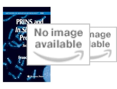 Amazon | Protein Aggregation: Methods and Protocols (Methods in ...