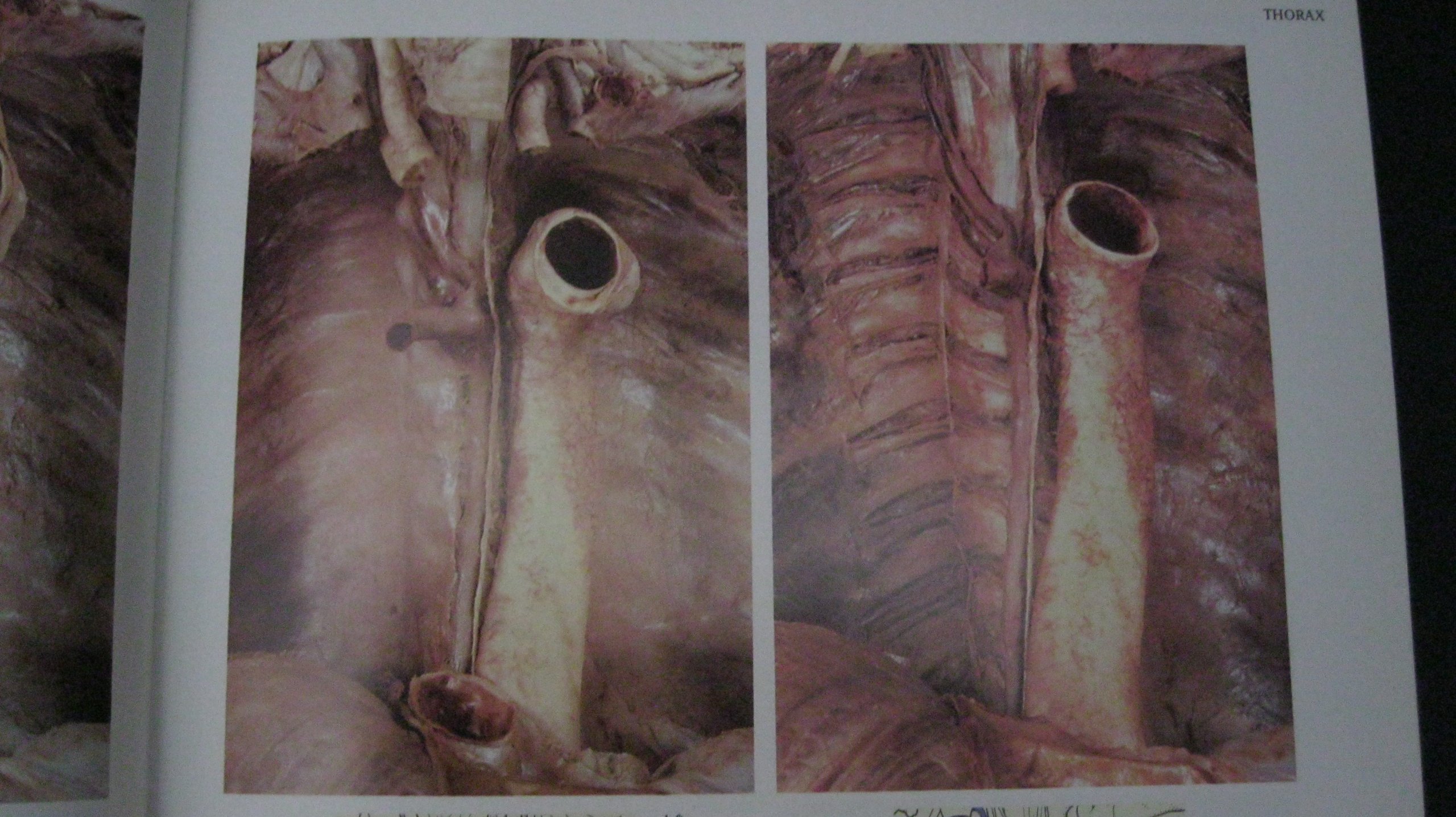 Atlas Human Anatomy & Integ Text