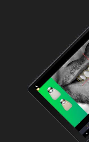 Dental Designer Pro