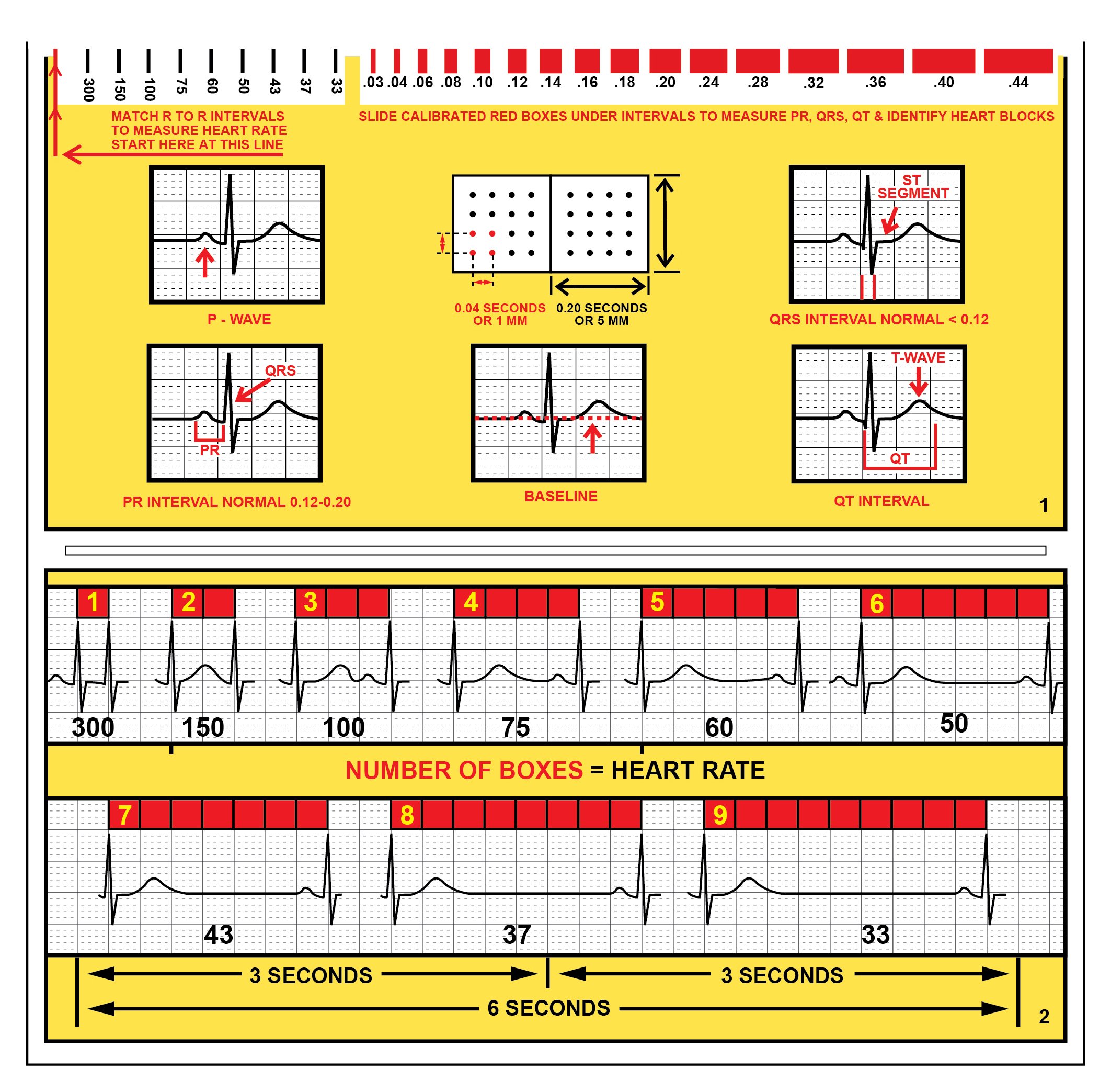 Snapklik.com : R-CAT For Arrhythmias EKG Pocket Reference Guide ...