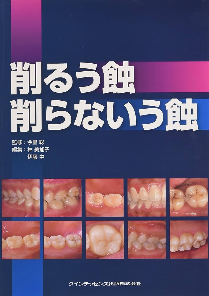 削るう蝕 削らないう蝕 削るう蝕 削らないう蝕 | 今里 聡, 林 美加子, 伊藤 中 |本