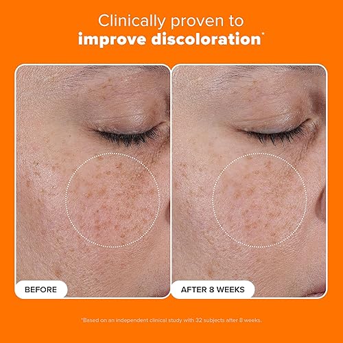 Miniatura 4 de Paula's Choice Suero con 25% de vitamina C con glutatión y antioxidantes, el suero facial mejora la decoloración, el tono desigual y reafirma, todo